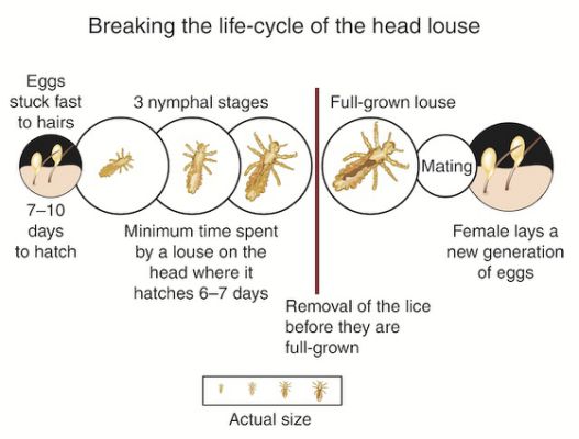 Breaking the life cycle of the head louse infograph